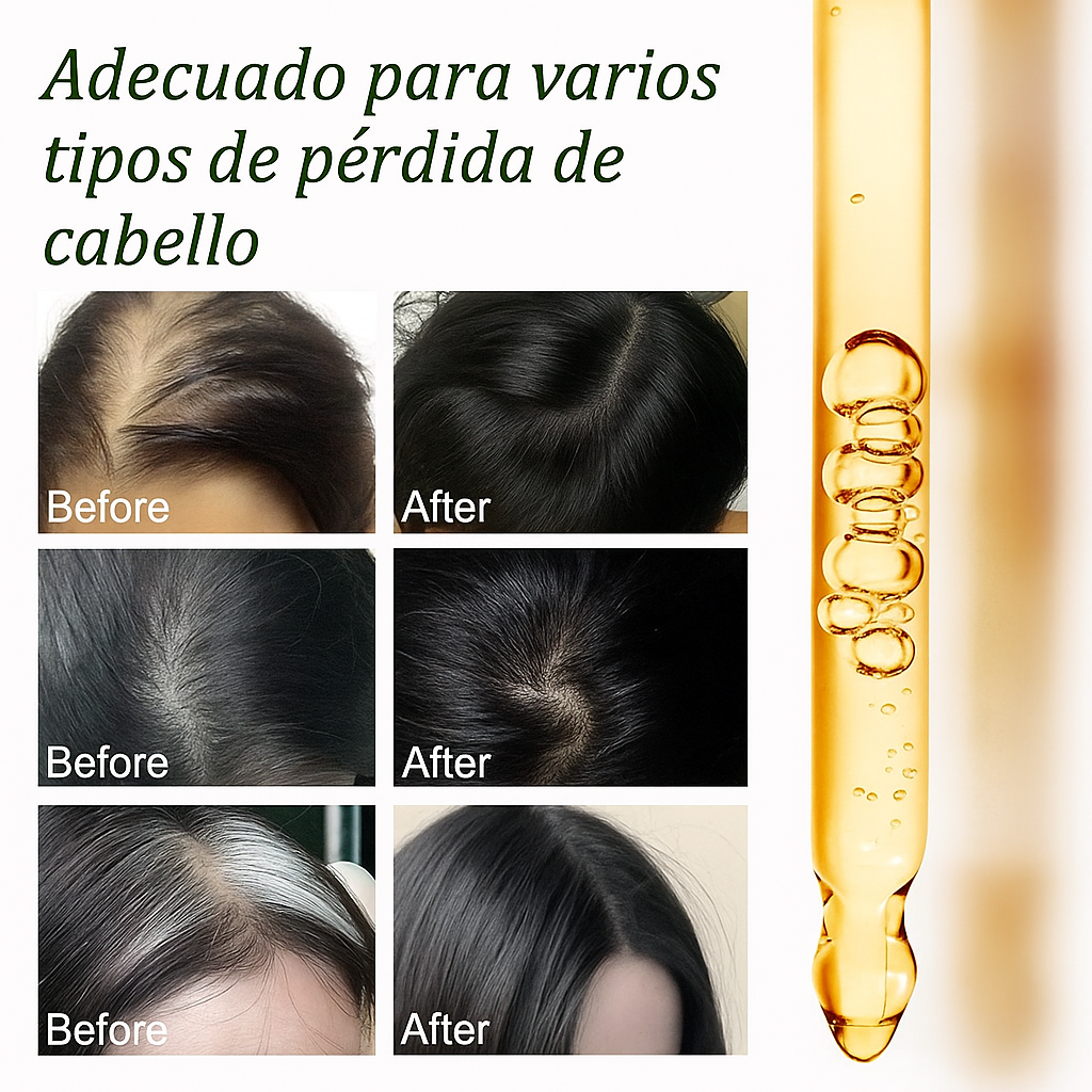 🌿 Recupera tu cabello de forma natural con Aceite Puro de Batana