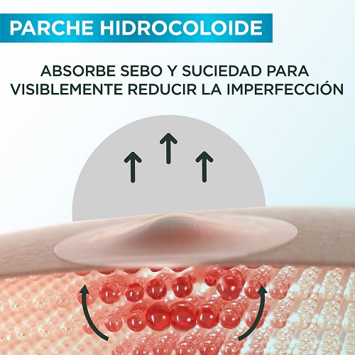 👀 ¿Te salió un grano? ¡Desaparecelo en 8 horas!