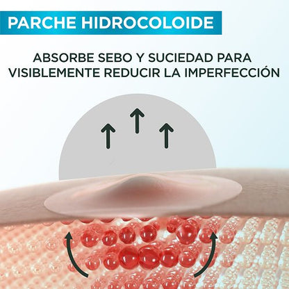 👀 ¿Te salió un grano? ¡Desaparecelo en 8 horas!